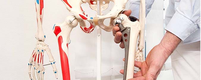 endoprotezirovanie-1